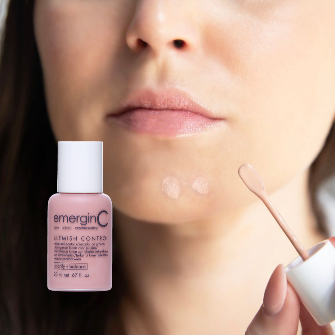 emerginC Tinted Blemish Control 20ml spot treatment shown being applied to active breakouts. Helps dry blemishes, reduce redness and calm irritated skin.
